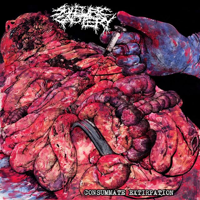 Sulfuric Cautery