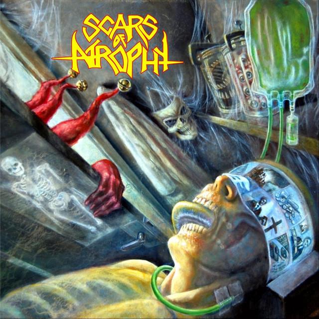 Scars of Atrophy