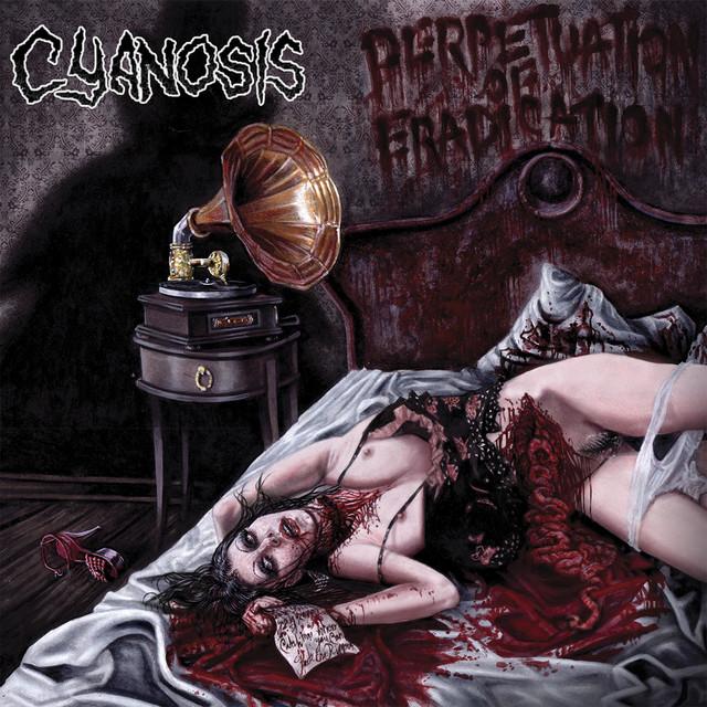 Cyanosis